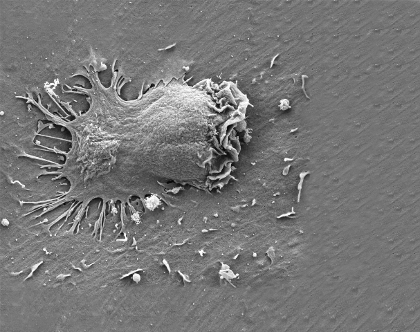 תצלום שבוצע באמצעות מיקרוסקופ אלקטרונים: תאים אפקטורים מחדירים רגליים דרך הקרום של תאי אנדותל